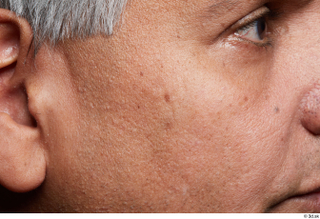 HD Face Skin John Deery cheek face skin pores skin…